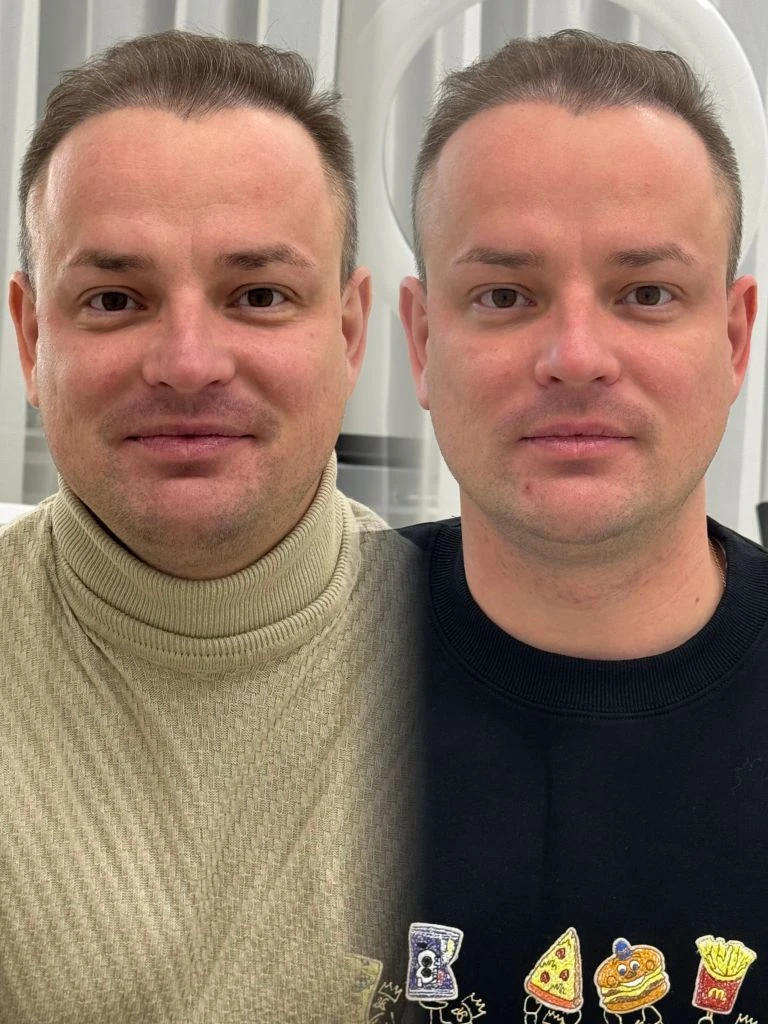 Мужская косметология Full Face — центр «Моя Молодость», Казань