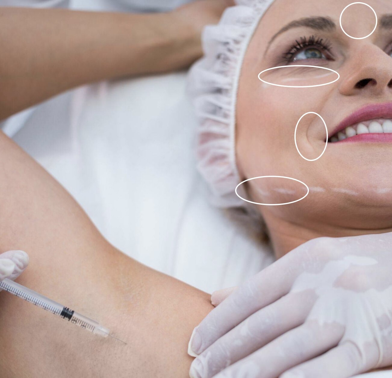 Botox/Диспорт/Xeomin/Релатокс Full Face + лечение гипергидроза «под ключ» — Ботулинотерапия в Казани