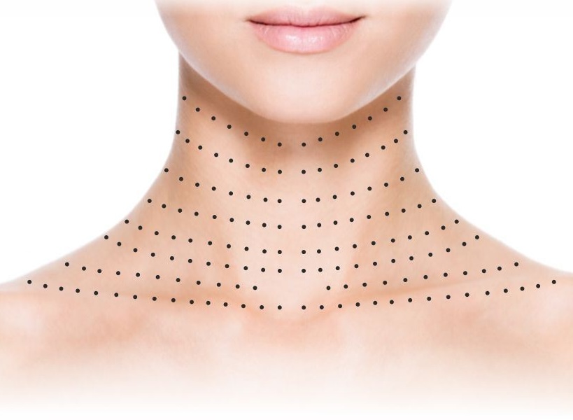 Botox/Диспорт/Xeomin/Релатокс Кольца венеры + зона декольте «под ключ» (омоложение шеи) — Ботулинотерапия в Казани